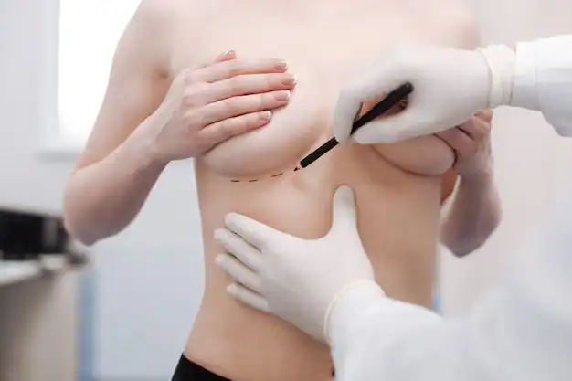 Breast Aesthetics in Turkey 91 Breast Augmentation turkey in istanbul cost